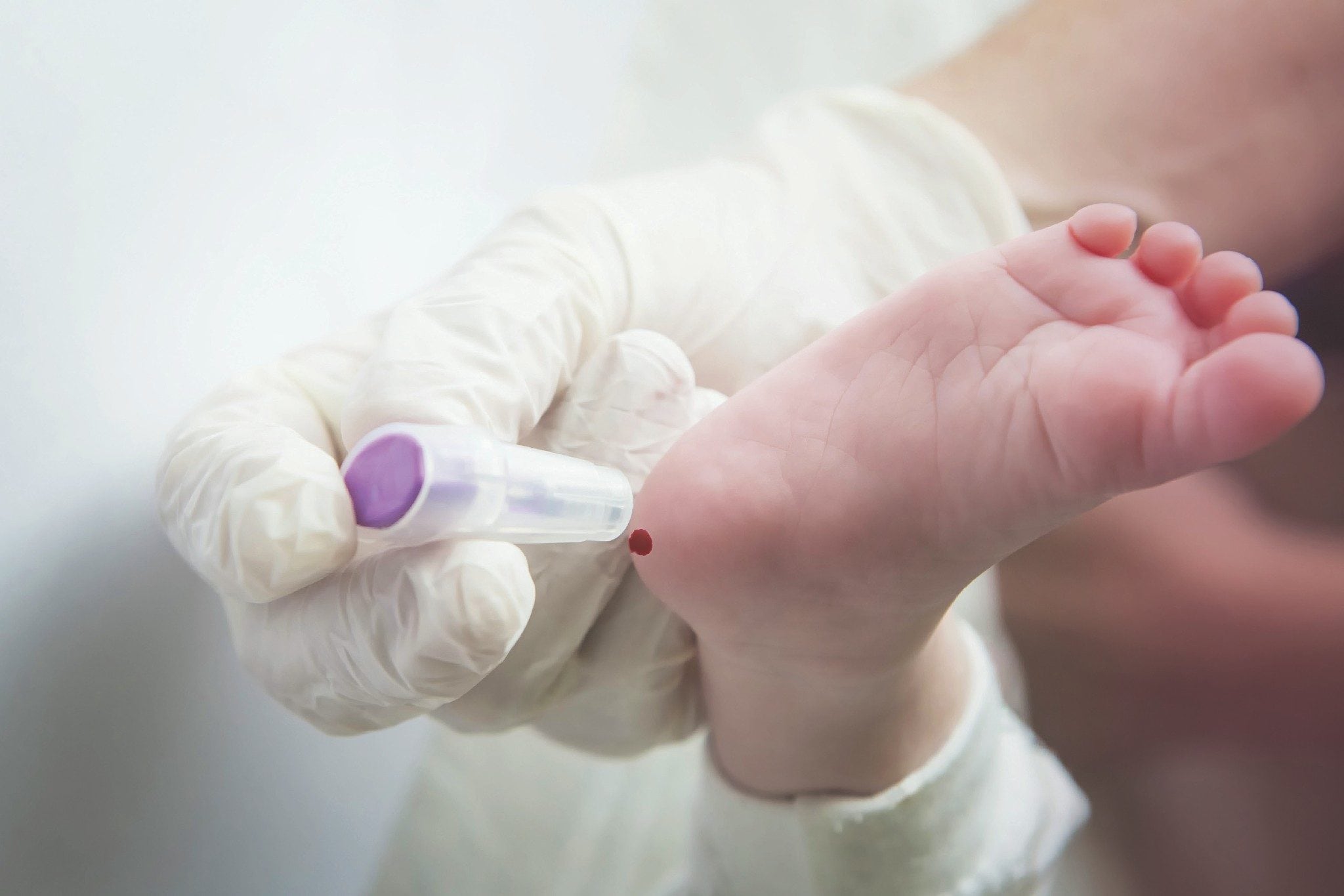 OMNI-Lab NBS meets all the requirements of the newborn screening laboratory.