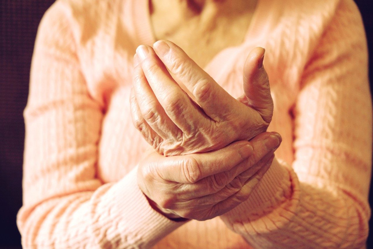 Elderly woman with arthritis in hands