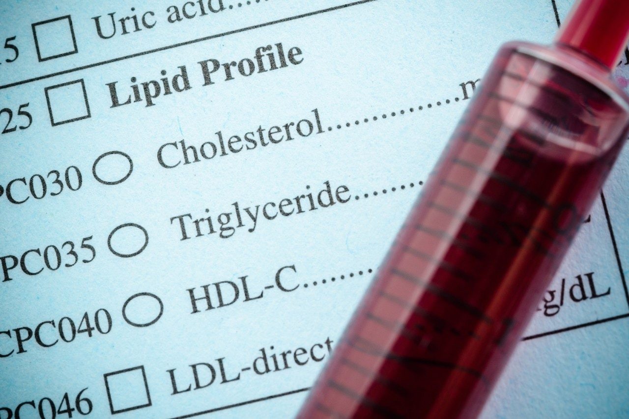 Cholesterol, triglyceride, and blood in syringe