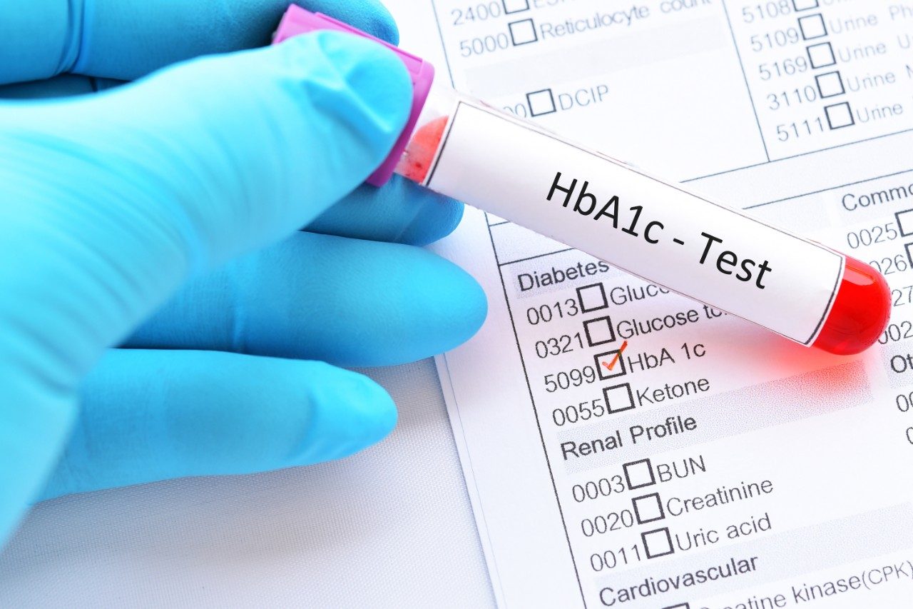 Blood sample tube with HbA1c diabetes test