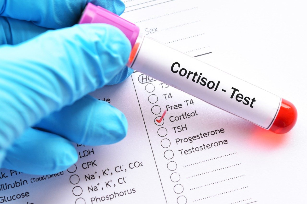 Blood sample for cortisol hormone test