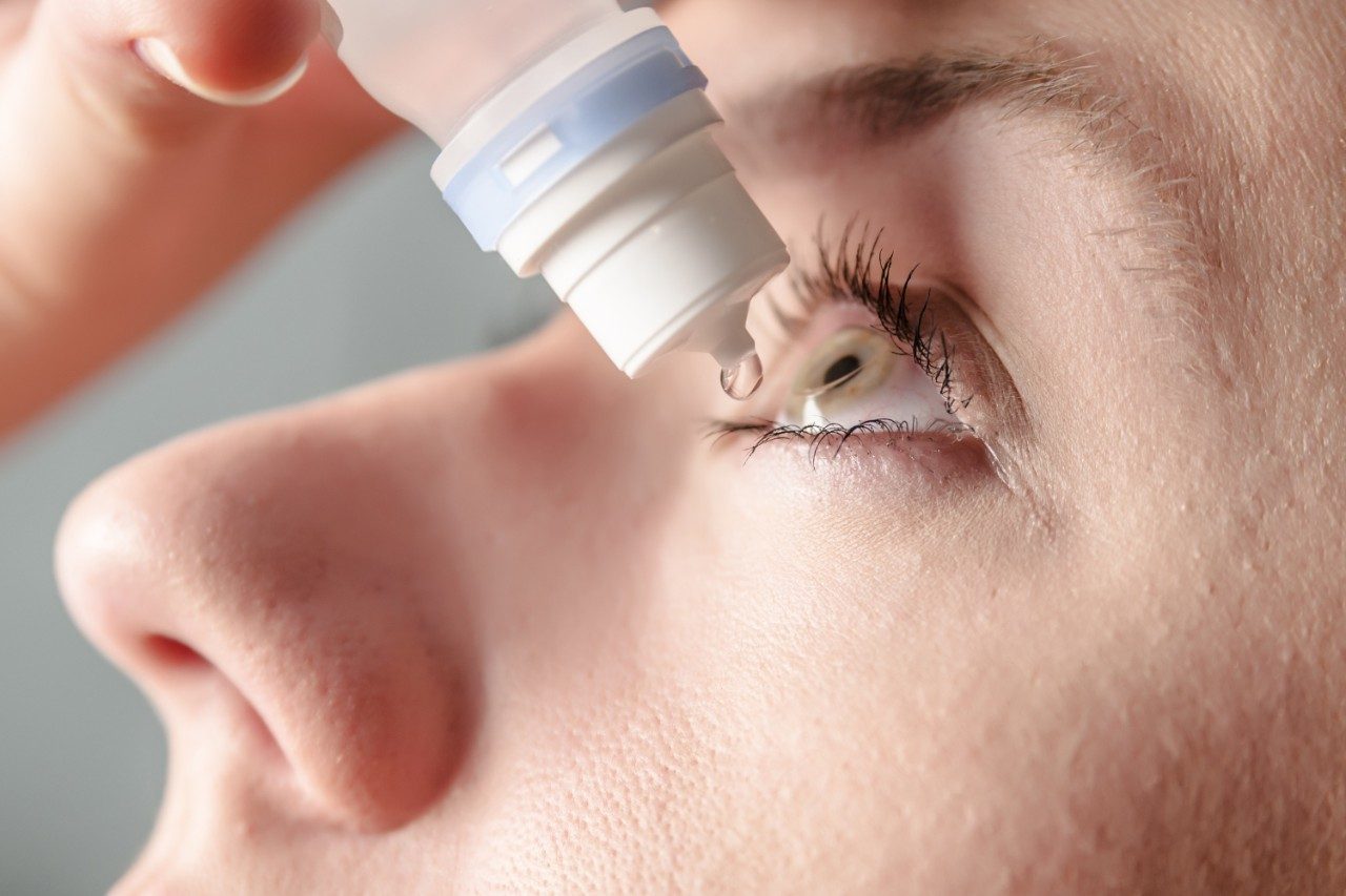 Woman applying eye drop or artificial tears