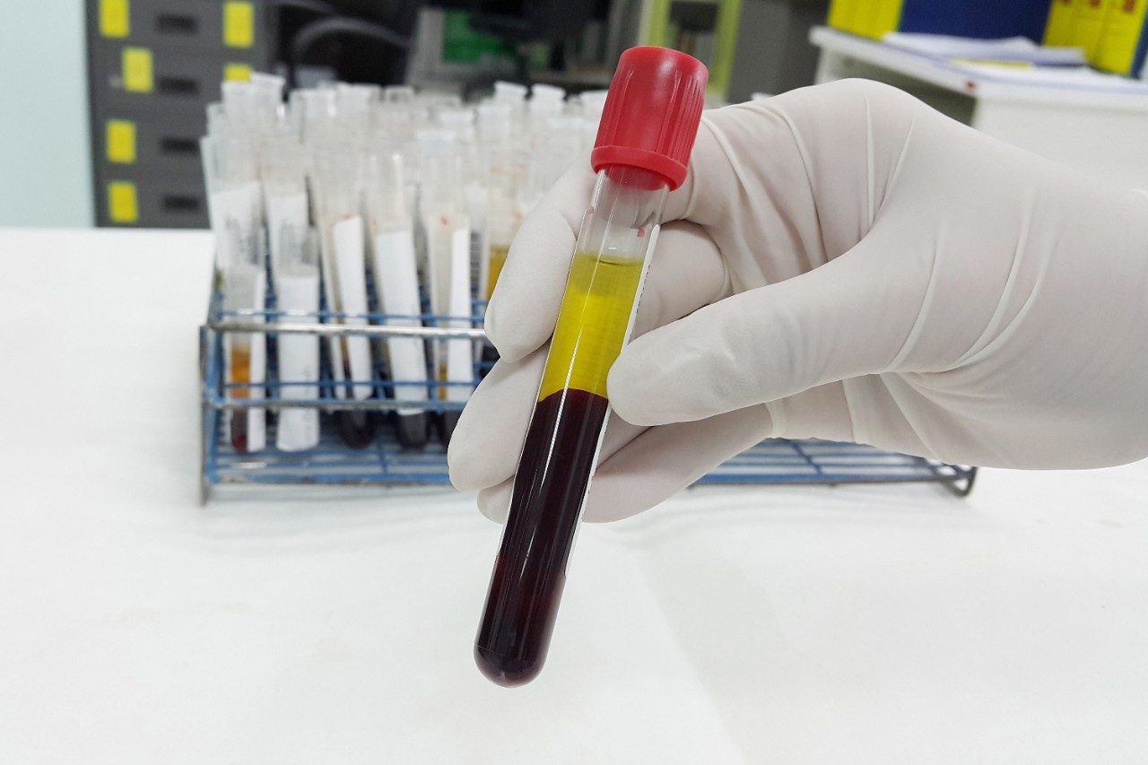 Human blood serum sample in tube in lab