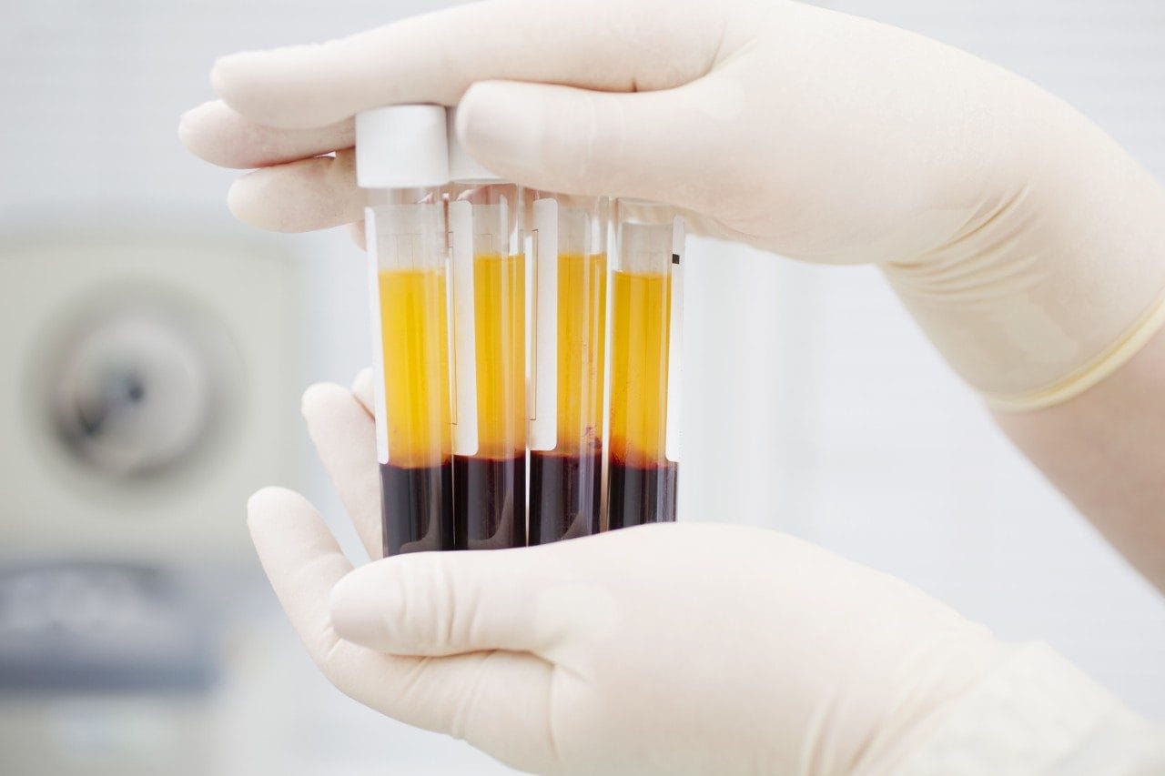 Blood plasma tubes in two layers divided by centrifuge