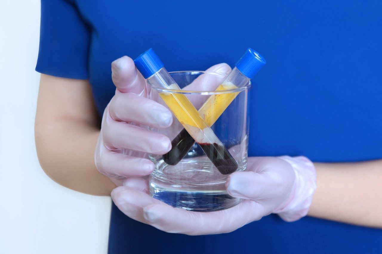 Two vials with blood plasma after centrifugation