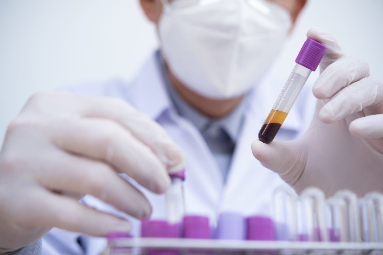 Technician holding test tube examining human centrifuged serum