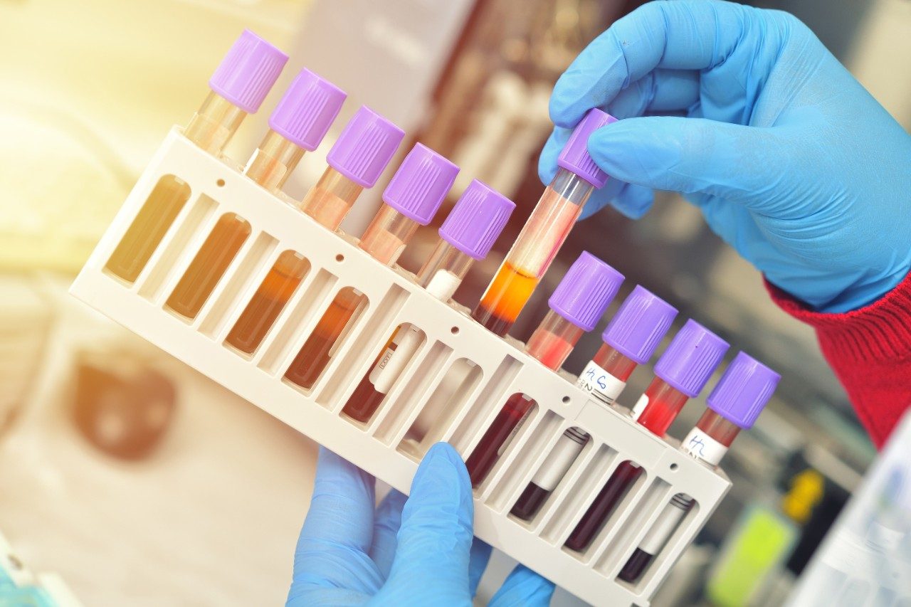 Tubes of blood plasma samples in rack