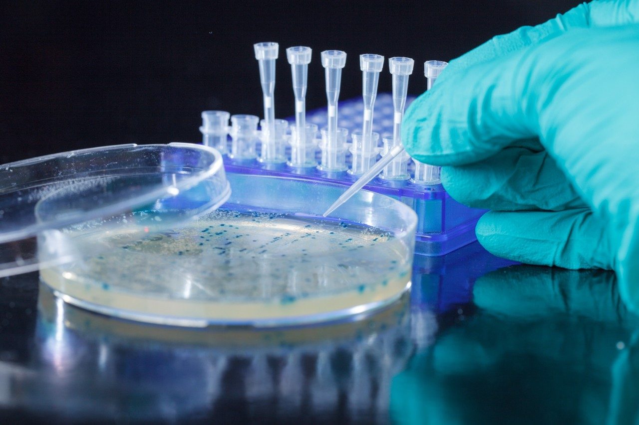 Scientist hand picks up bacterial colonies for cloning of transgenic vector into plasmid DNA