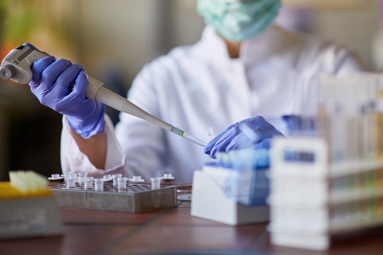 Researcher in lab using pipette for blood analysis