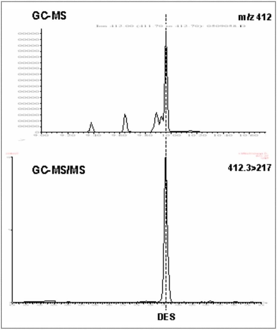 Urine spiked with 1.5 ppb diethylstilbestro