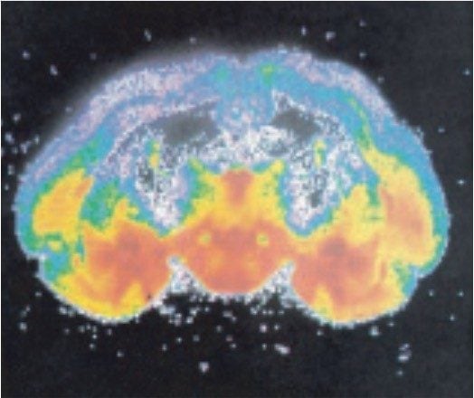 Image of guinea-pig brain