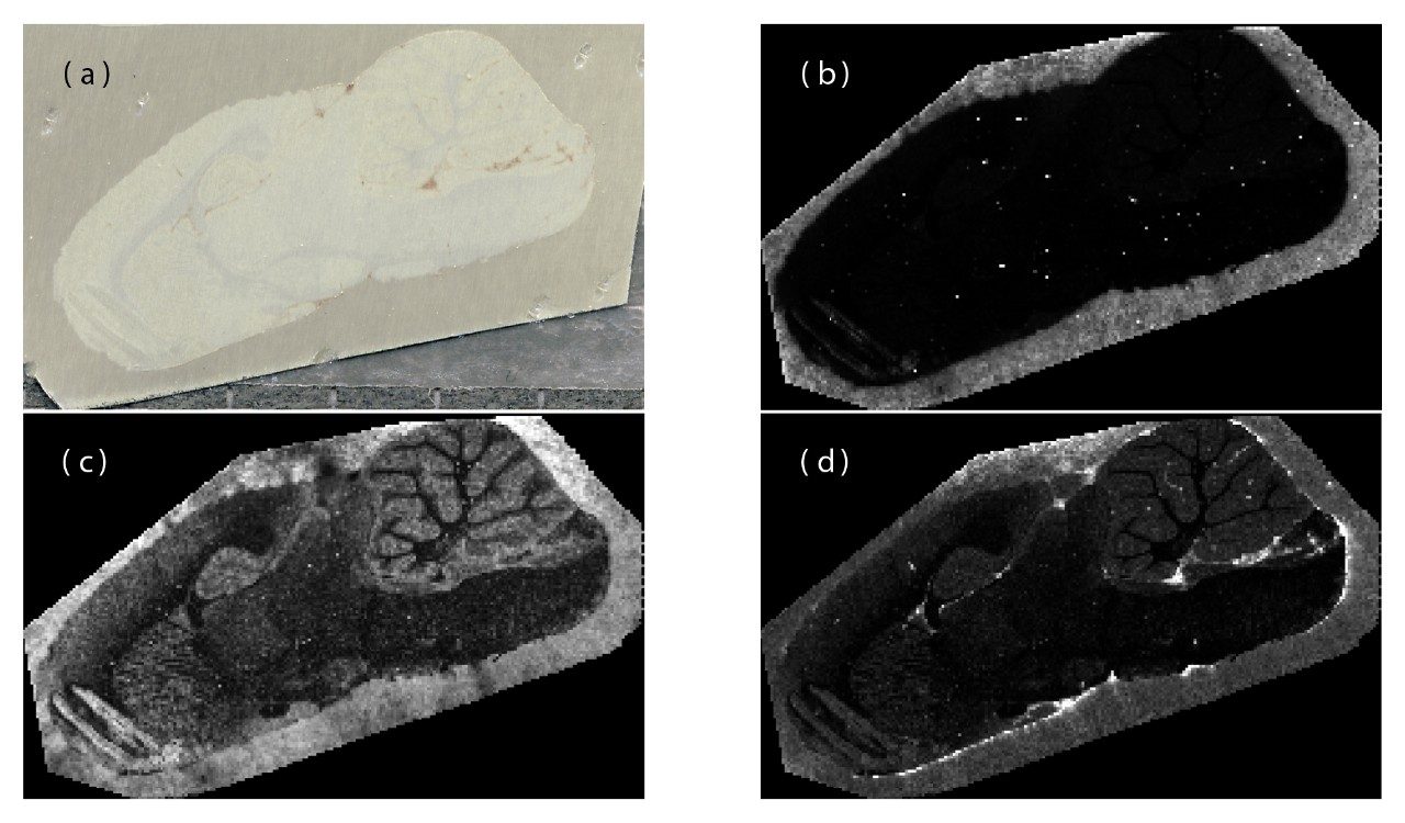 Examples of MALDI images