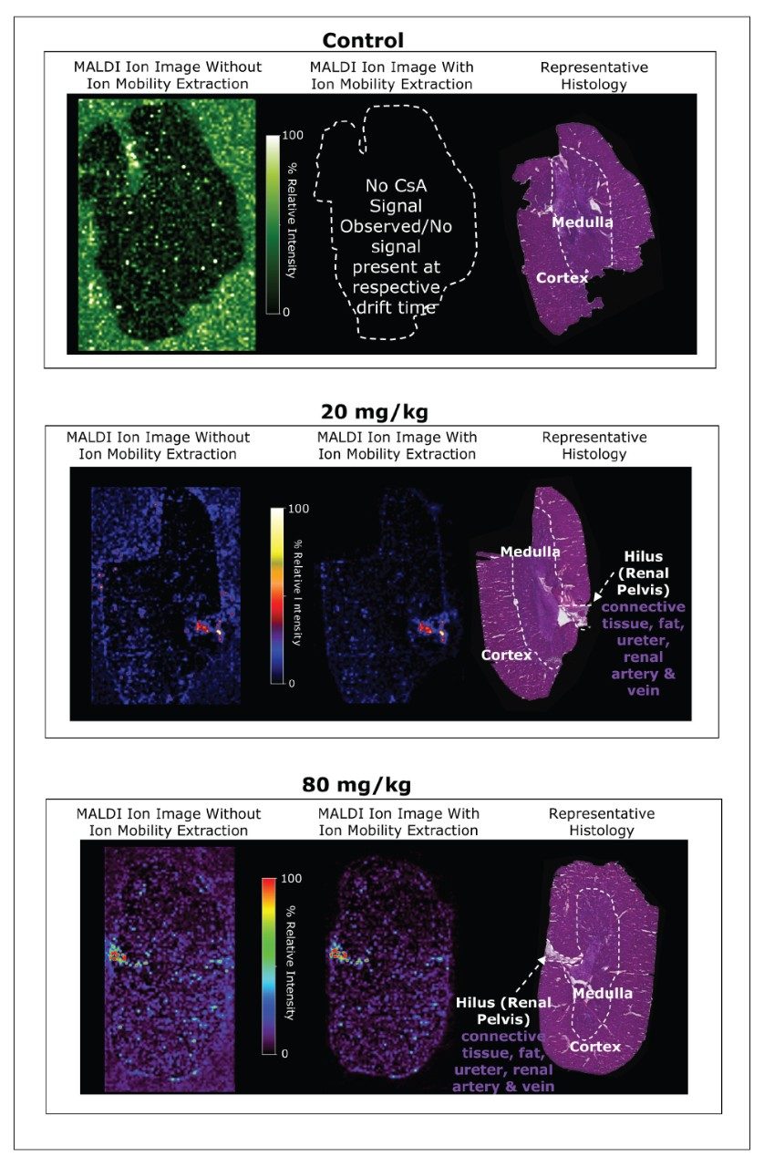 CsA ion reconstituted images of control, 20 mg/kg, and 80 mg/kg-dosed kidney, with and without ion mobility separation, compared to the histology image