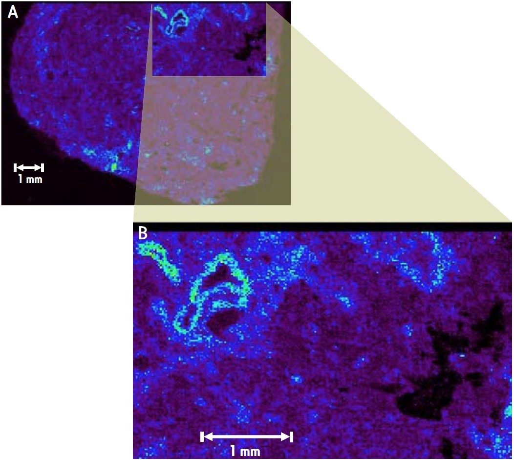 Localization of different ions within the tissue section