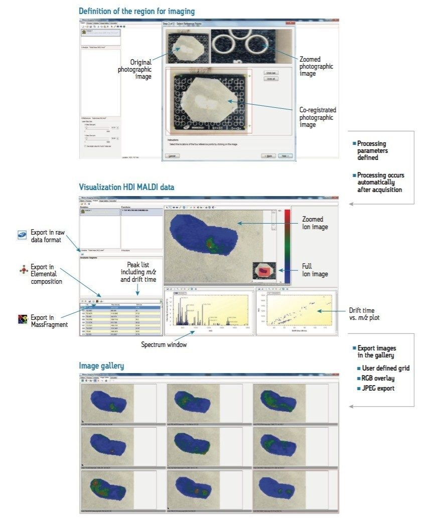 Acquired imaging data