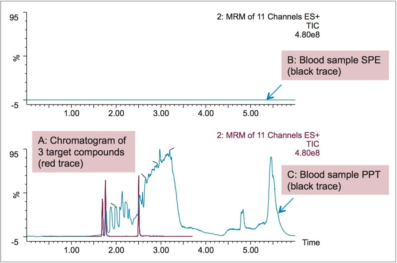 Chromatography of phospholipids 