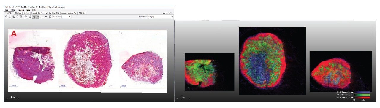 Displaying multiple ion disctributions as a RGB overlay for multiple samples in the same project (m/z 885.6 (red), 700.5 (green), and 687.6 (blue))